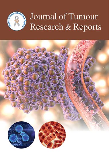 Guidelines About Journal Of Tumour Research And Reports - Hoki Slot138