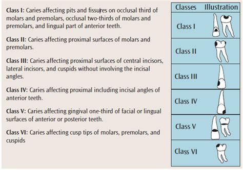 Gv Black's Classification