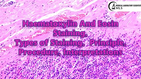 H And E Staining