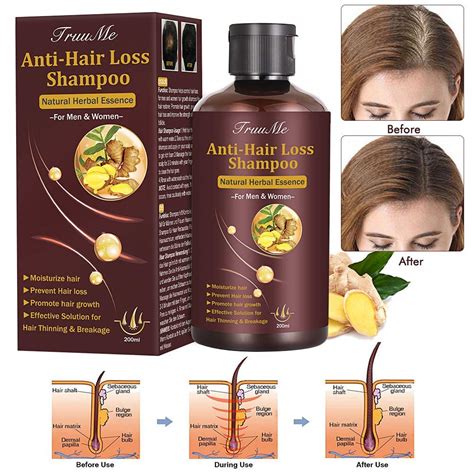 Hair Regrowth Shampoos The One Product That Really Hair Science Shampoo - Hair Science Shampoo