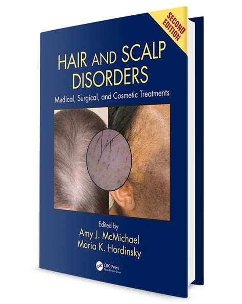 Read Hair And Scalp Disorders Medical Surgical And Cosmetic Treatments 