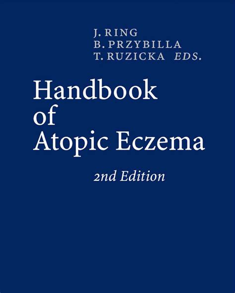 Read Handbook Of Atopic Eczema 