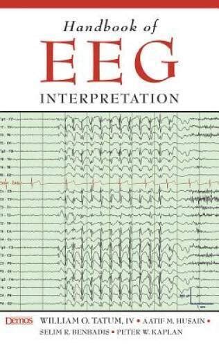 Read Handbook Of Eeg Interpretation 
