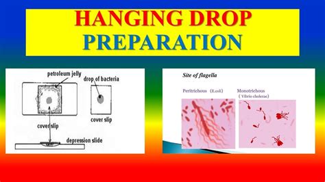 Hanging Drop Preparation