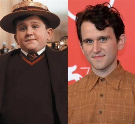 harry melling nude