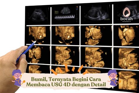 HASIL USG 4D - Interpretasi perbedaan detak pembuluh darah janin pada USG 4D