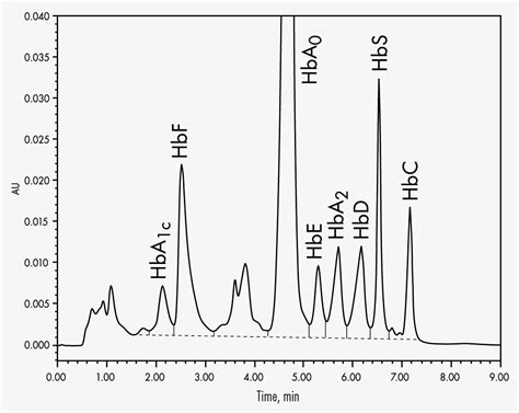 Hb Hplc Test