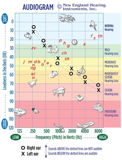 Hearing Range By Age Chart
