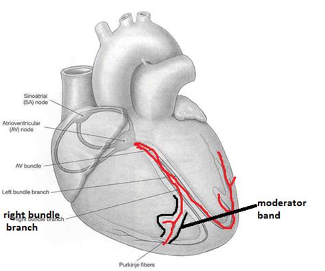 Heart Moderator Band