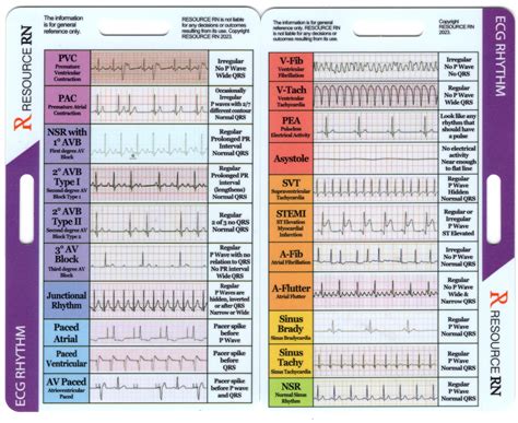 Heart Rhythm Strips