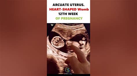 Heart Shaped Womb