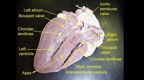 Full Download Heart Dissection Lab Guide 