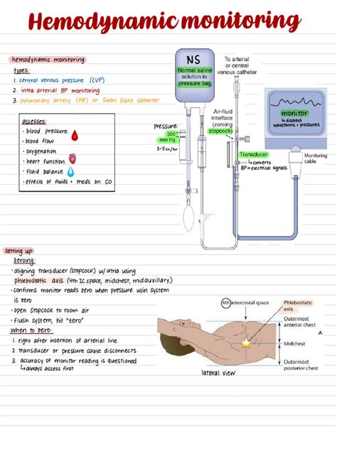 Hemodynamic Monitoring Made Easy
