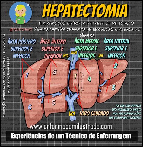 hepatectomia