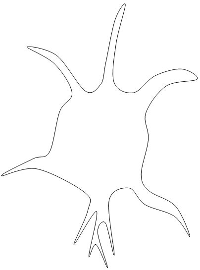 hereditär polyneuropati