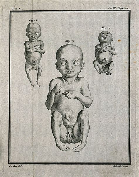 Hermaphroditic Picture