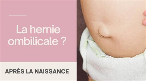 Hernie Ombilicale Bébé
