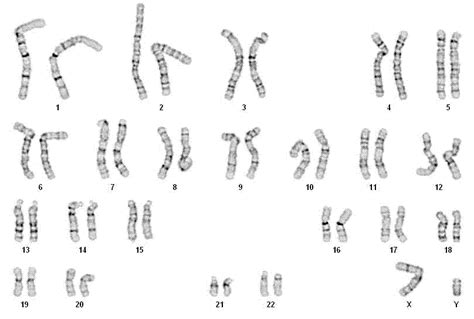 Read Online High Resolution And Karyotype Protocol 