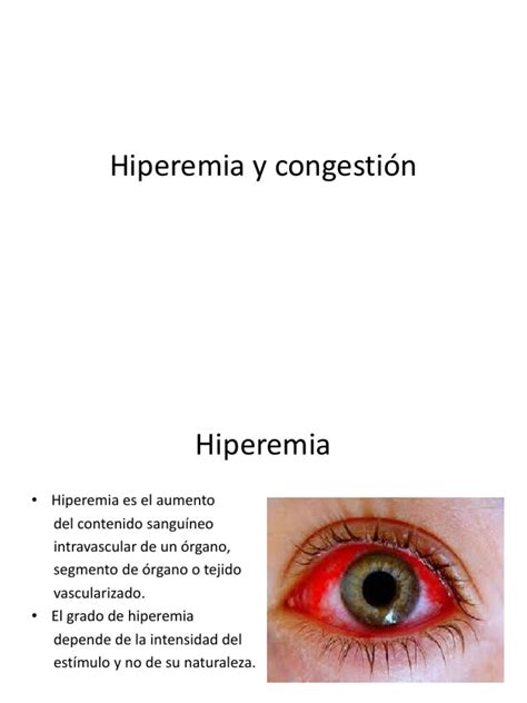 hiperemia-4