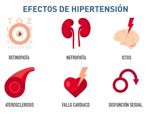 hipertensión 2 a
