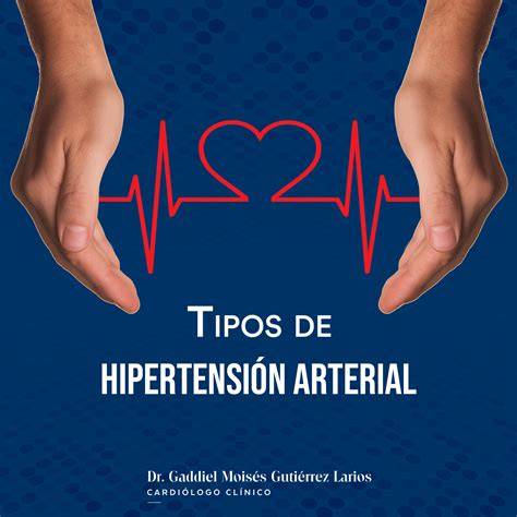hipertensión 2do