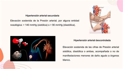 hipertensión MIA