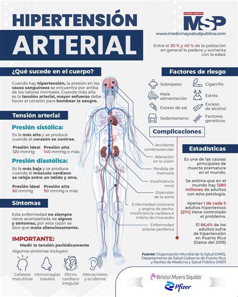 hipertensión fb2