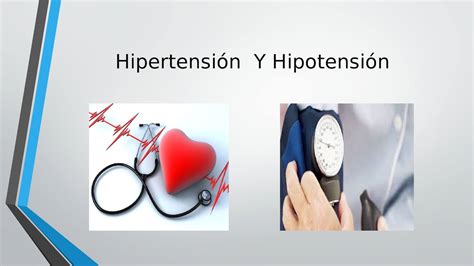 hipotensión