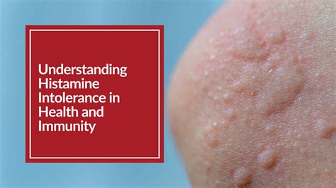 histamine | Histamine Kontrol Mikroba SinnTech 20th Webinar Terbaru