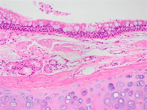 histology for pathologists