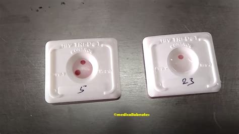Hiv Tridot Test