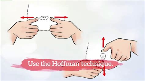 hoffman technique for inverted nipples video