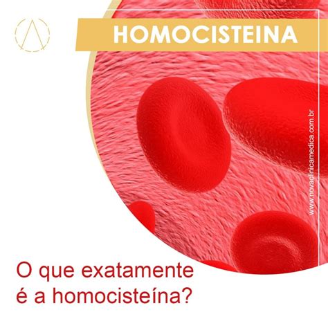 homocisteina