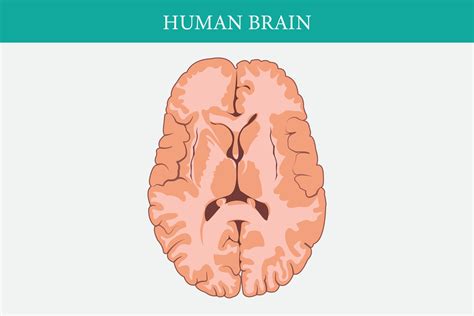 horizontal cross sections of brain