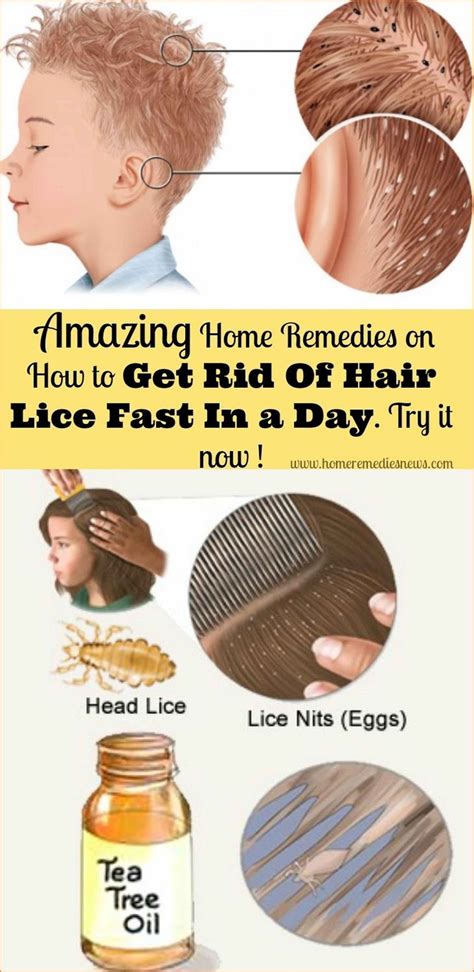 Modernalternativemama | How to treat a toddler with lice naturally