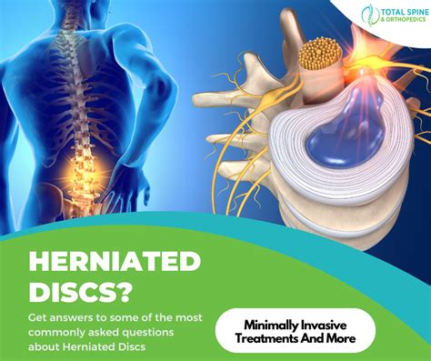 how bad is a herniated disk