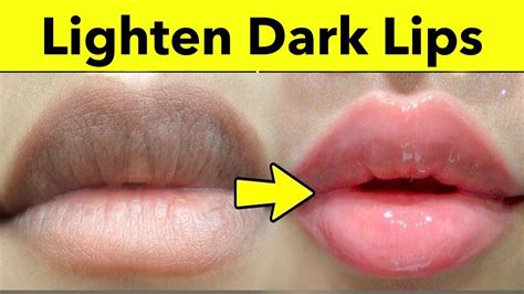 how can i lighten my dark lips treatment