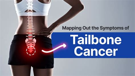 how common is tailbone cancer