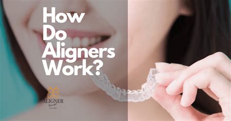 how do aligners work