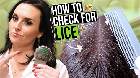how do you check hair for lice without