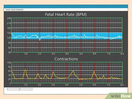 How Do You Read Contraction Monitor