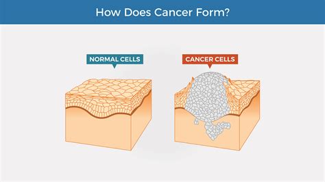 how does cancer cause illness