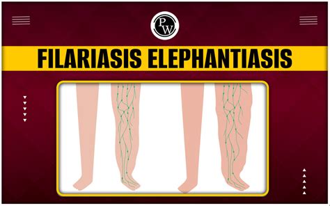 how does elephantiasis spread