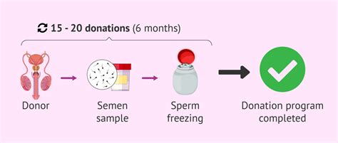 how does the sperm donor process work