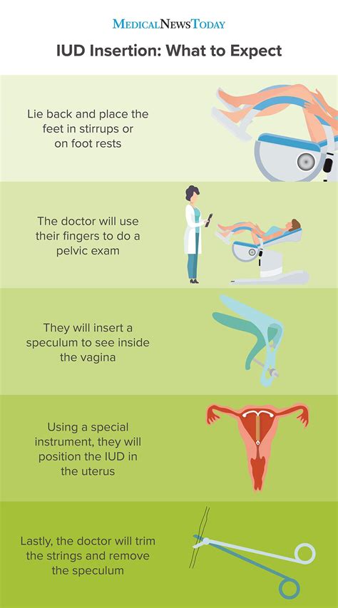 how effective is iud after insertion