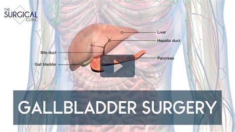 how gallbladder is diagnosed