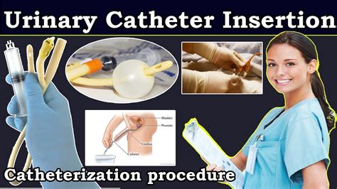 how is a catheter inserted
