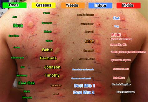 how is allergy testing done on adults