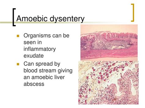 how is amoebic dysentery transmitted