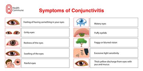 how is conjunctivitis spread